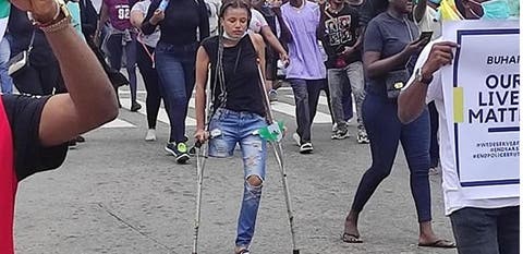 #EndSARS protester gets N4.1m for prosthetic leg